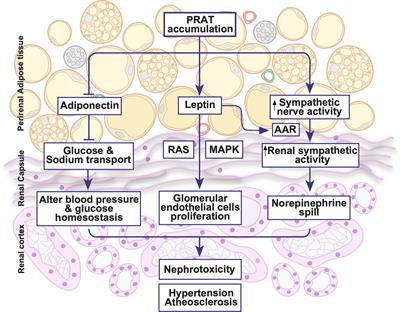 Perirenal Adipose Tissue Inflammation: Novel Insights Linking Metabolic Dysfunction to Renal Diseases